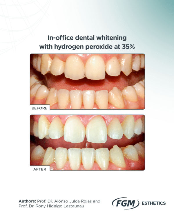 Wit HP Block - Image 6