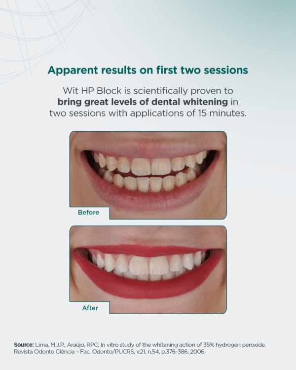 Wit HP Block - Image 4