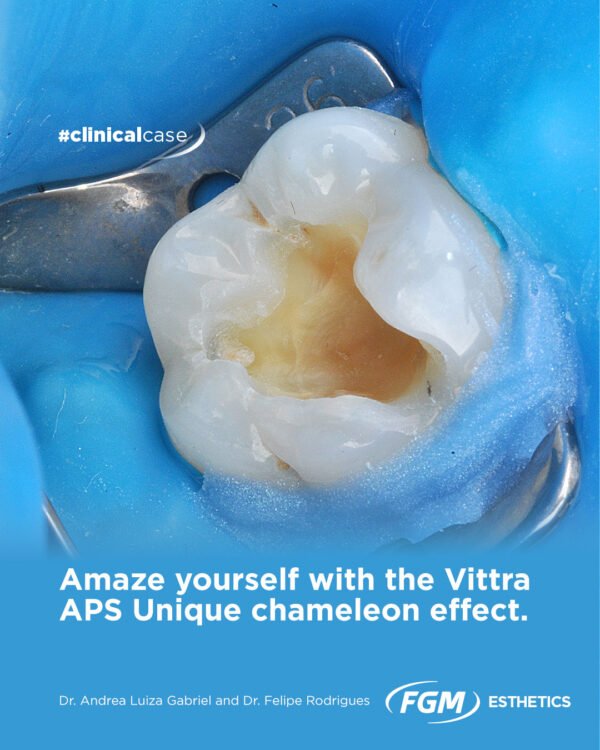 Vittra APS Unique - Image 2