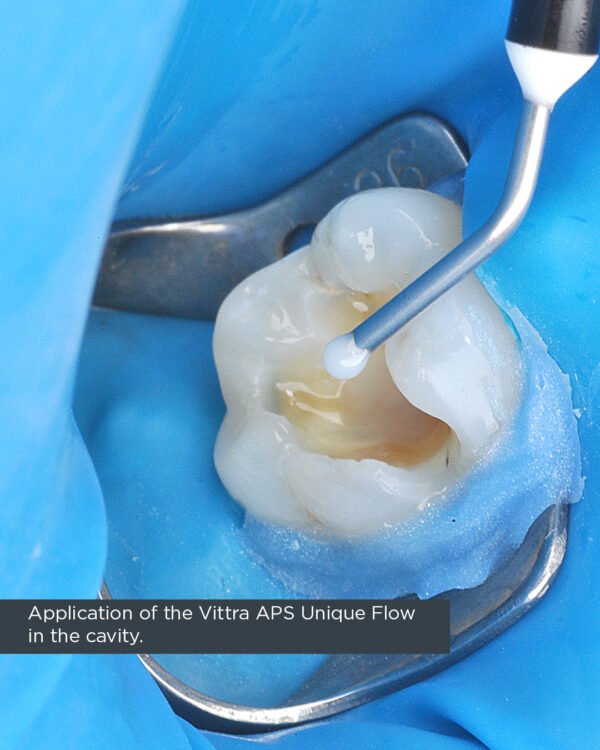 Vittra APS Unique - Image 3