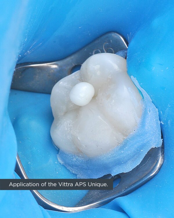Vittra APS Unique - Image 4