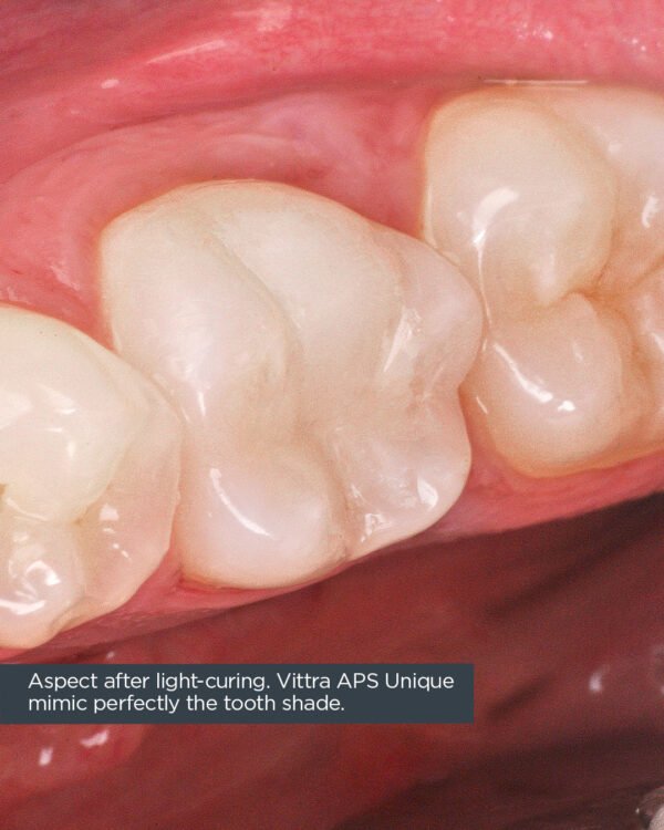 Vittra APS Unique - Image 5